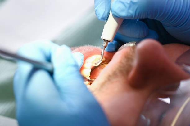 Best Tooth Infection Emergency Dentist  in Brazil, IN